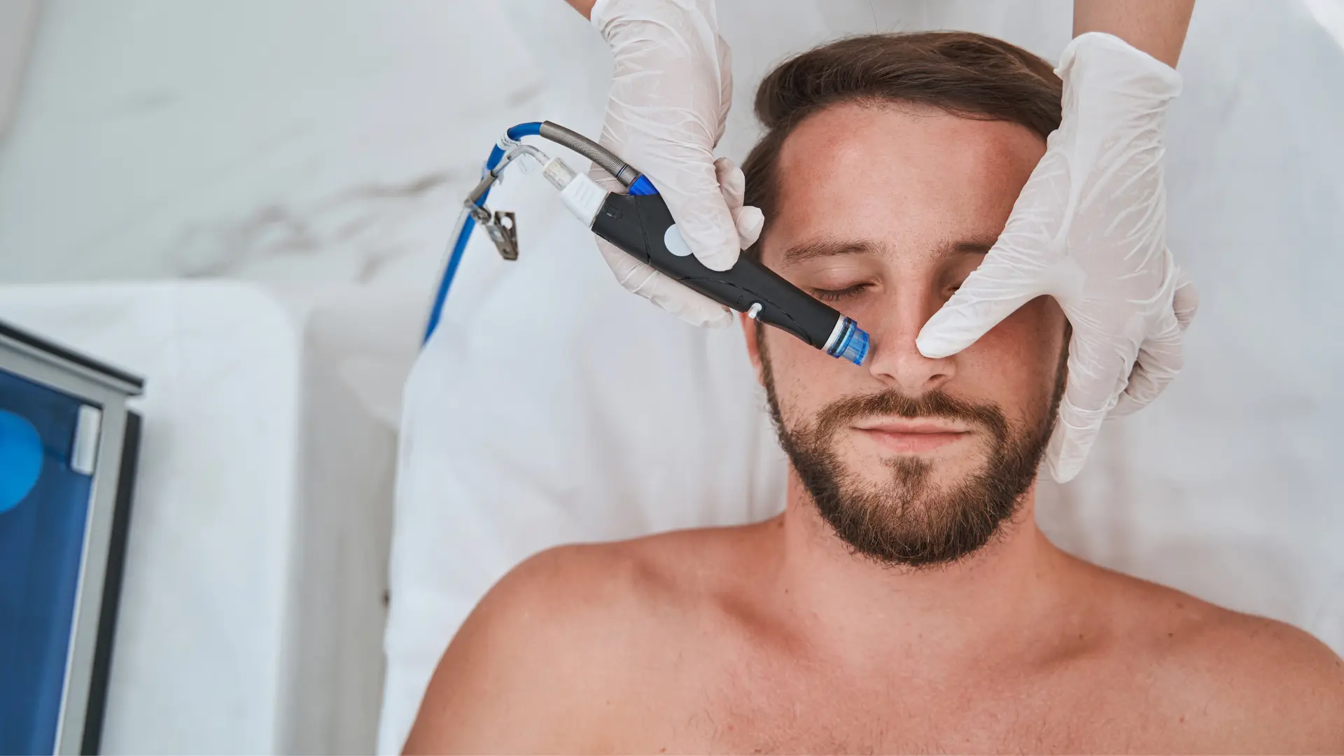 Hombre realizándose un tratamiento de Hidrodermoabrasión en Ancha Estética Cádiz