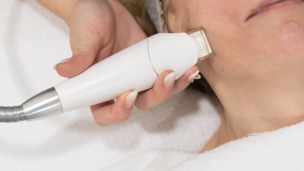 Mujer Tratamiento del LPG Facial antes y después Ancha Estética Cádiz