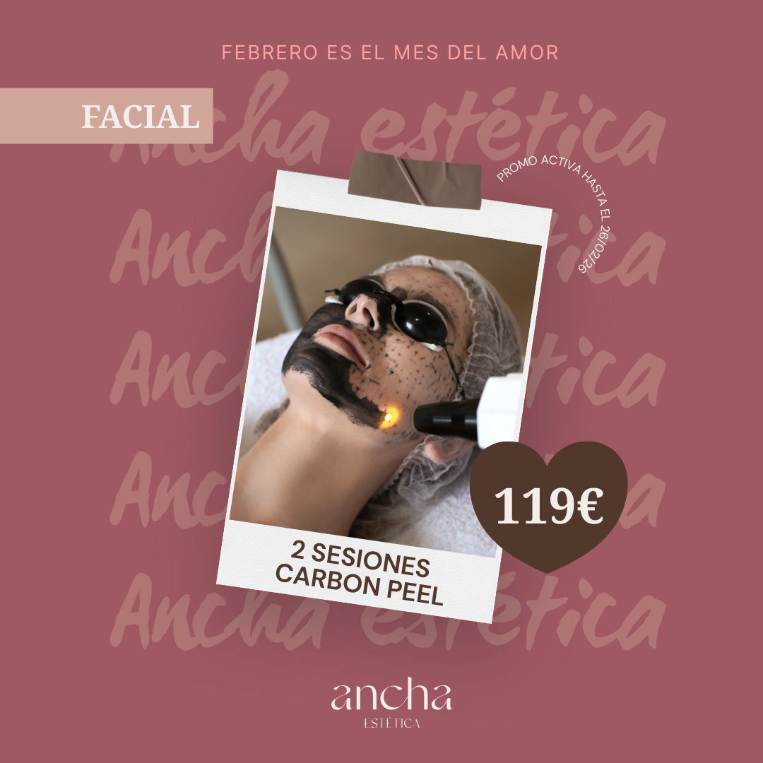 2 SESIONES CARBON PEEL ANCHA ESTETICA CADIZ