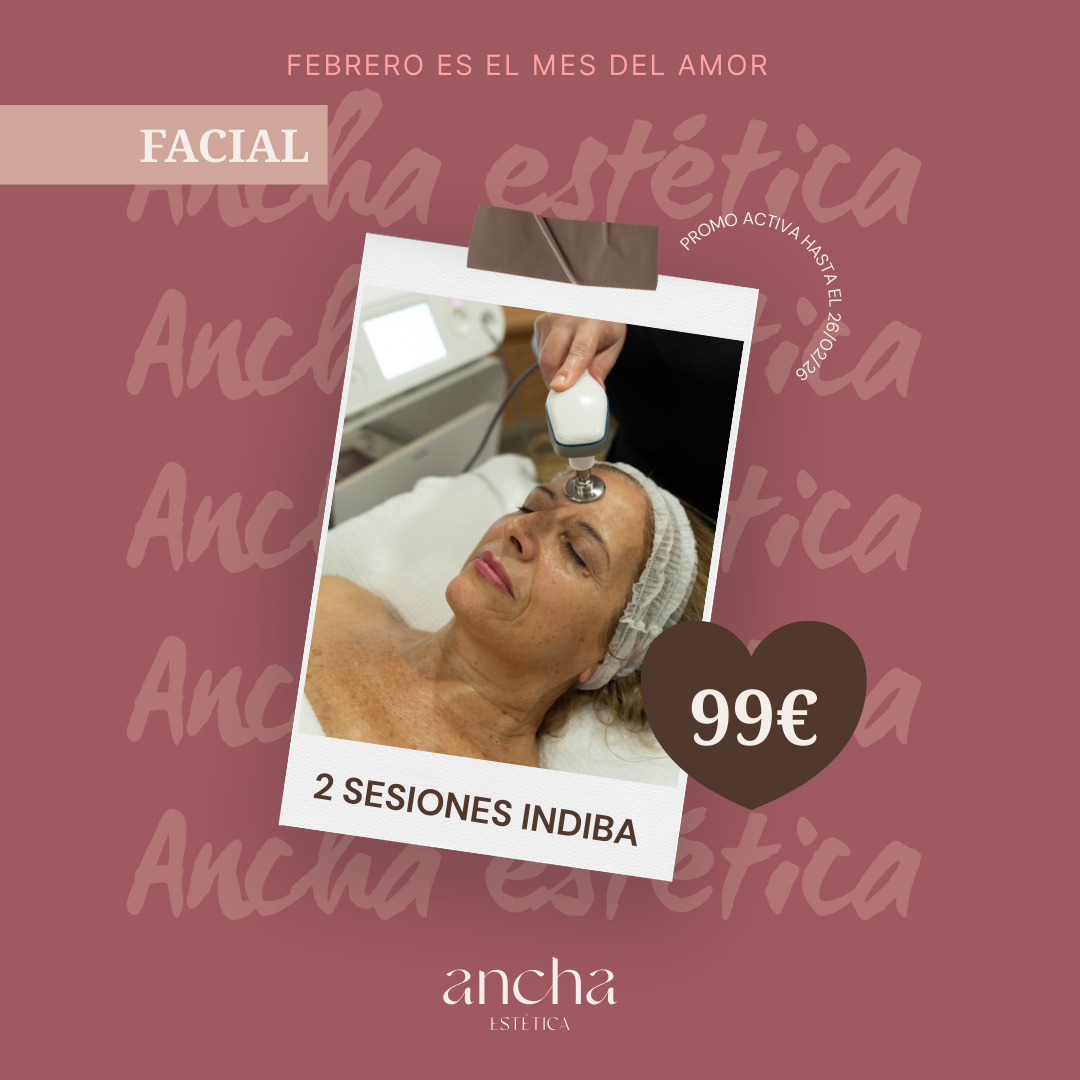 2 SESIONES INDIBA FACIAL ANCHA ESTETICA CADIZ