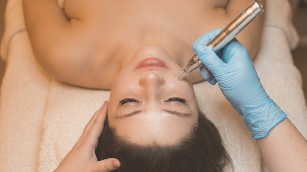 Mujer primer plano sometiendose a un Tratamiento de Dermapen en Cádiz en Ancha Estética