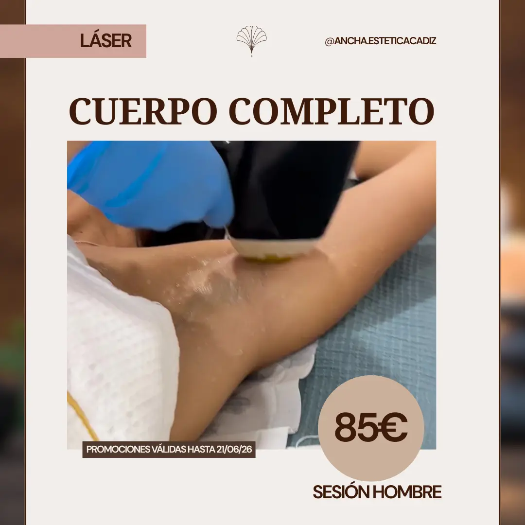 Sesión láser cuerpo completo hombre