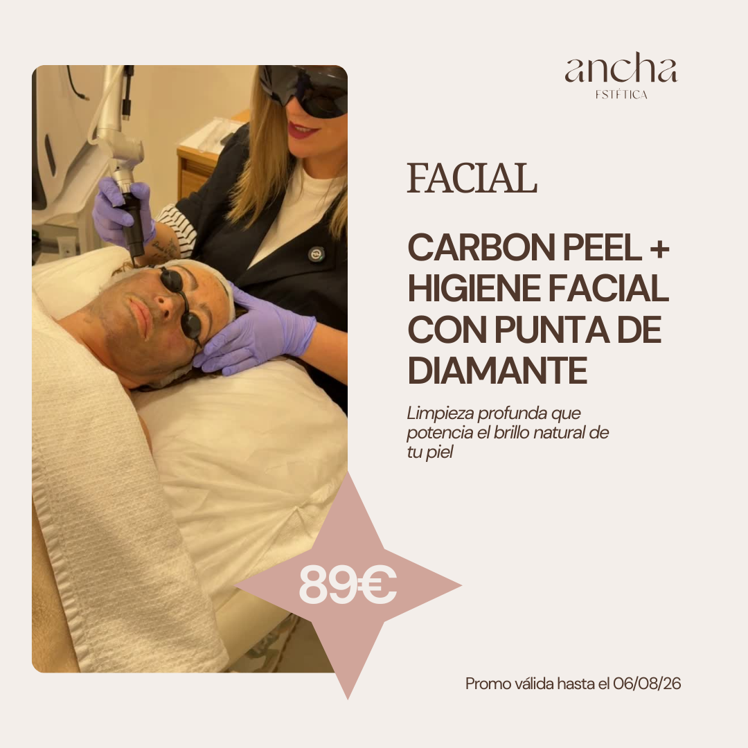 CARBON PEEL + HIGIENE FACIAL CON PUNTA DE DIAMANTE