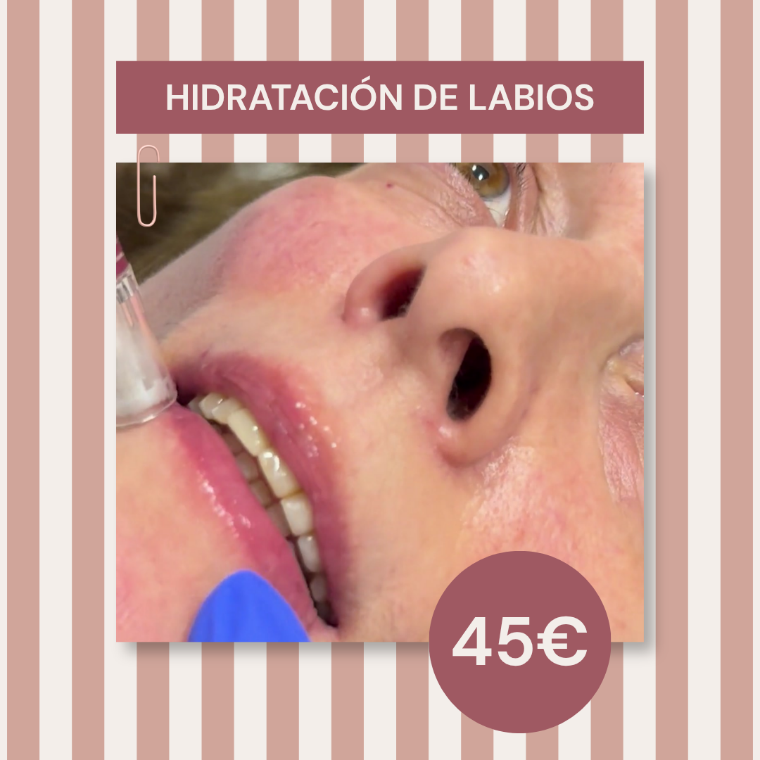 HIDRATACIÓN DE LABIOS