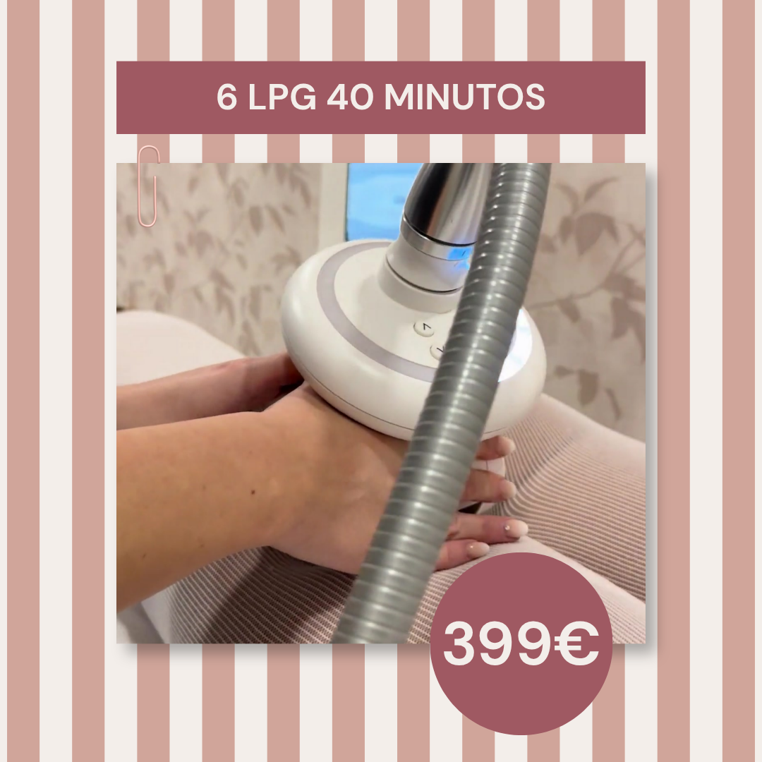 6 LPG 40 MINUTOS