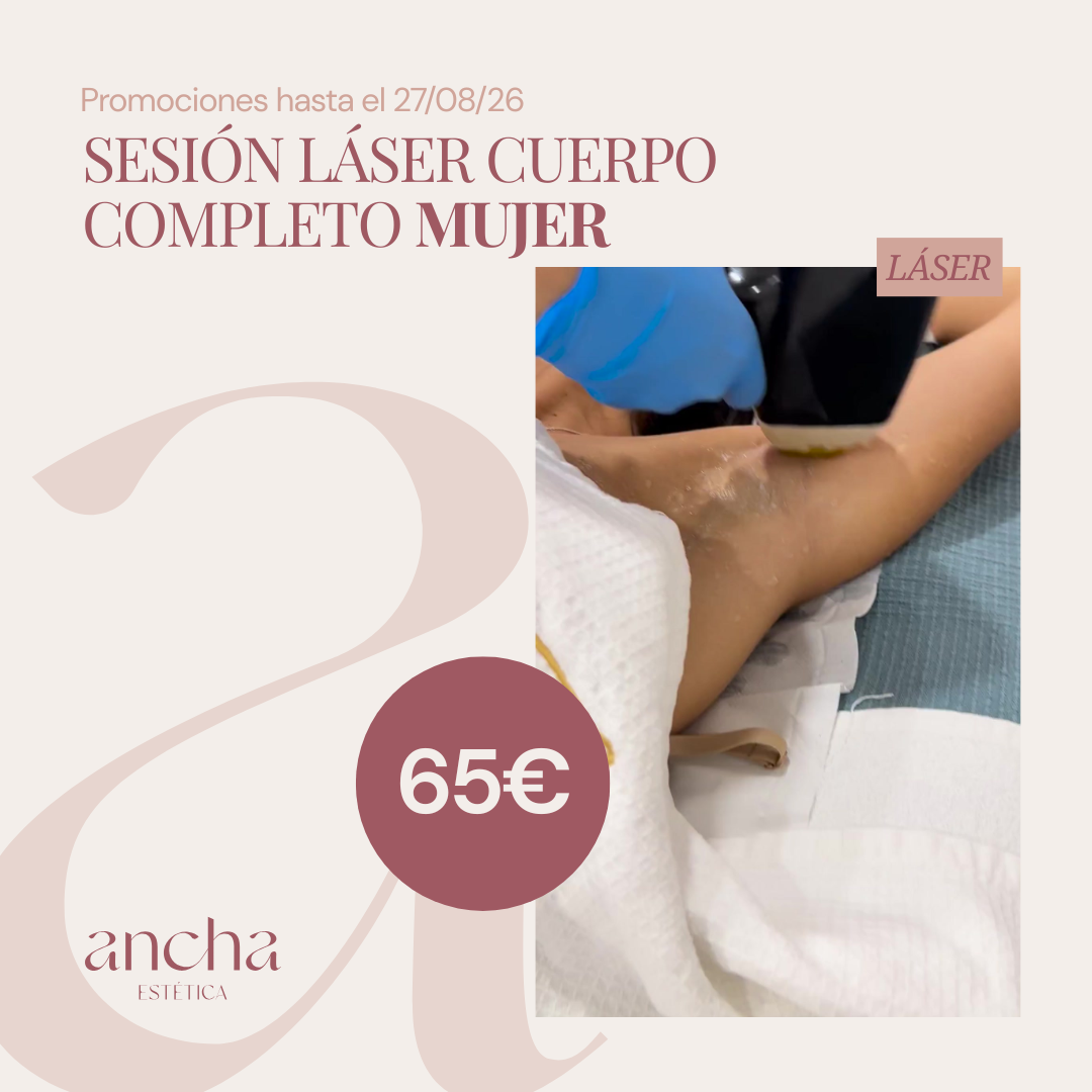 SESIÓN LÁSER CUERPO COMPLETO MUJER