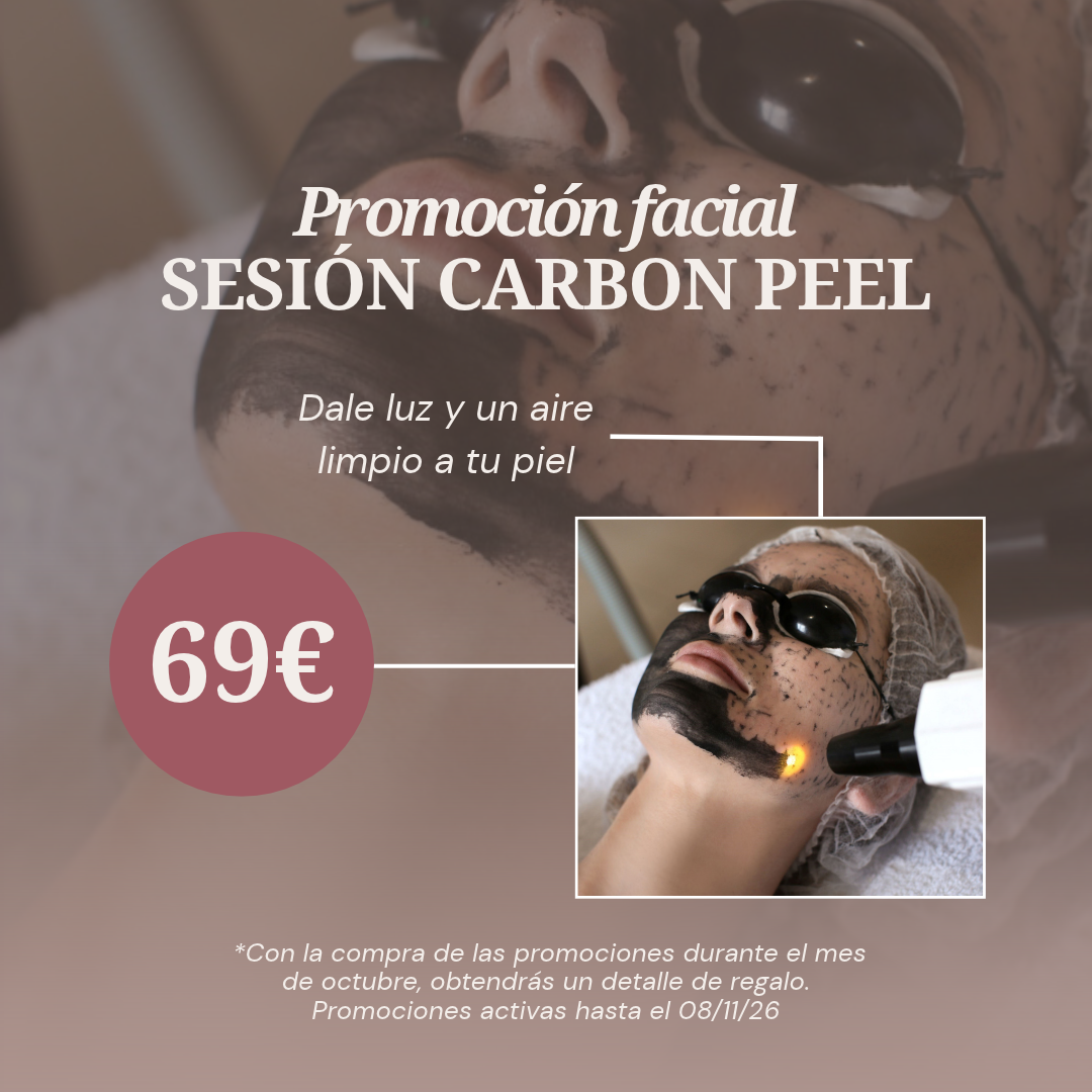 SESIÓN CARBON PEEL